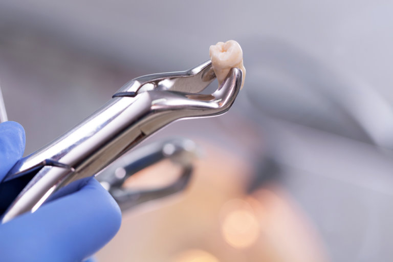 Dental,Equipment,Holding,An,Extracted,Tooth